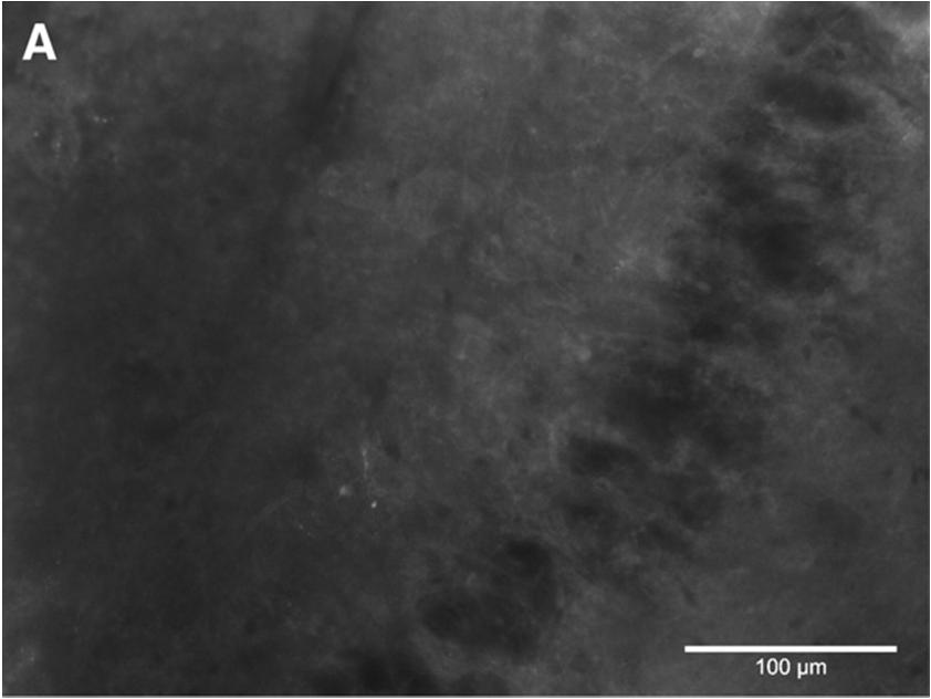 Hipocampus szöveteket kezeltünk 5 percig a sejtpenetráló szubsztrát oldatával (c=50 µm),