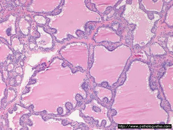 nőnek: Sanderson polster nincs fibrovascularis tengelyük (