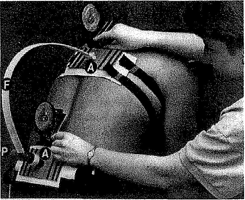 lo.ábra: Elektromos goniometer A goniométer szögmérői segítségével a teljes test térbeli mozgása vizsgálható 1 l.