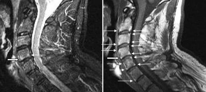 ARTHRITIS & RHEUMATISM Vol. 63, No. 8, August 2011, pp 2215 2225 DOI 10.1002/art.