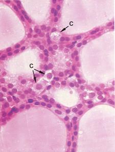 A follicularis és a C-sejtek is hormont termelnek F K Follicularis sejt (F) : egyrétegű lap- vagy köbhám sötét (basophil) citoplazma thyroglobulint termel és választ ki a folliculus üregébe: