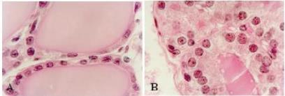 A follicularis sejtek alakja és mérete funkcionálisan változik Hypoaktív fázis: ellapult follicularis sejtek, nagy üreg kolloid tárolás Aktív