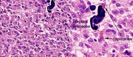 sejtek (astrocyta) Kötőszövetes