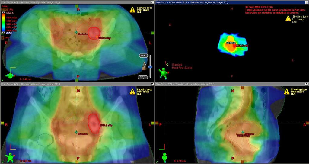 PET-CT