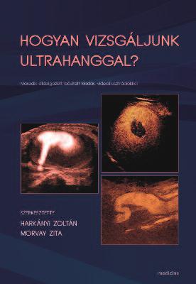 Hogyan vizsgáljunk ultrahanggal? Szerkesztette: Harkányi Zoltán, Morvay Zita Medicina Könyvkiadó Zrt., 2016 1. táblázat. A,,Hogyan vizsgáljunk ultrahanggal c.