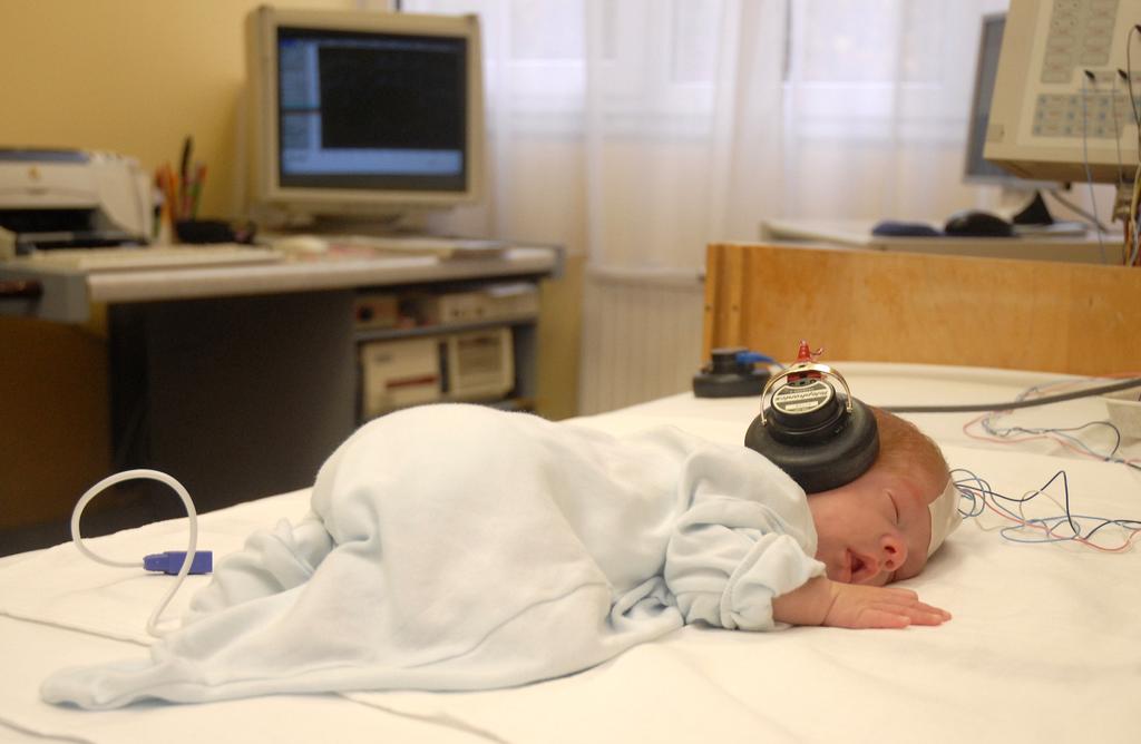 Korai idegrendszeri károsodások: korai diagnosztika, prognózis és terápia csecsemő esetében, akinek az anamnézisében hypoxia illetve asphyxia szerepel, vagy az előzetes neonatológiai vizsgálatok,
