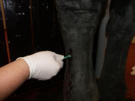 Lymphangitis Cellulitis és lymphangitis klinikai elkülönítése nehéz, biopszia nélkül gyakran nem lehetséges Klasszikus formái a járványos nyirokérgyulladás (Histoplasma