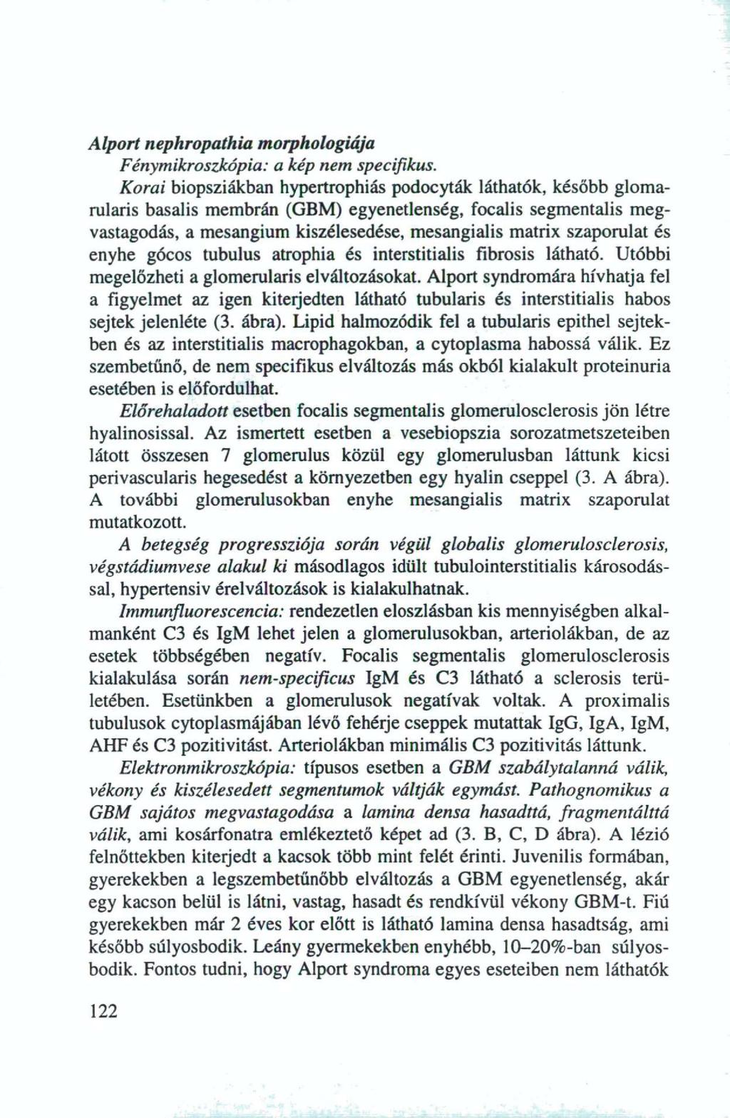 Alport nephropathia morphologiája Fénymikroszkópia: a kép nem specifikus.