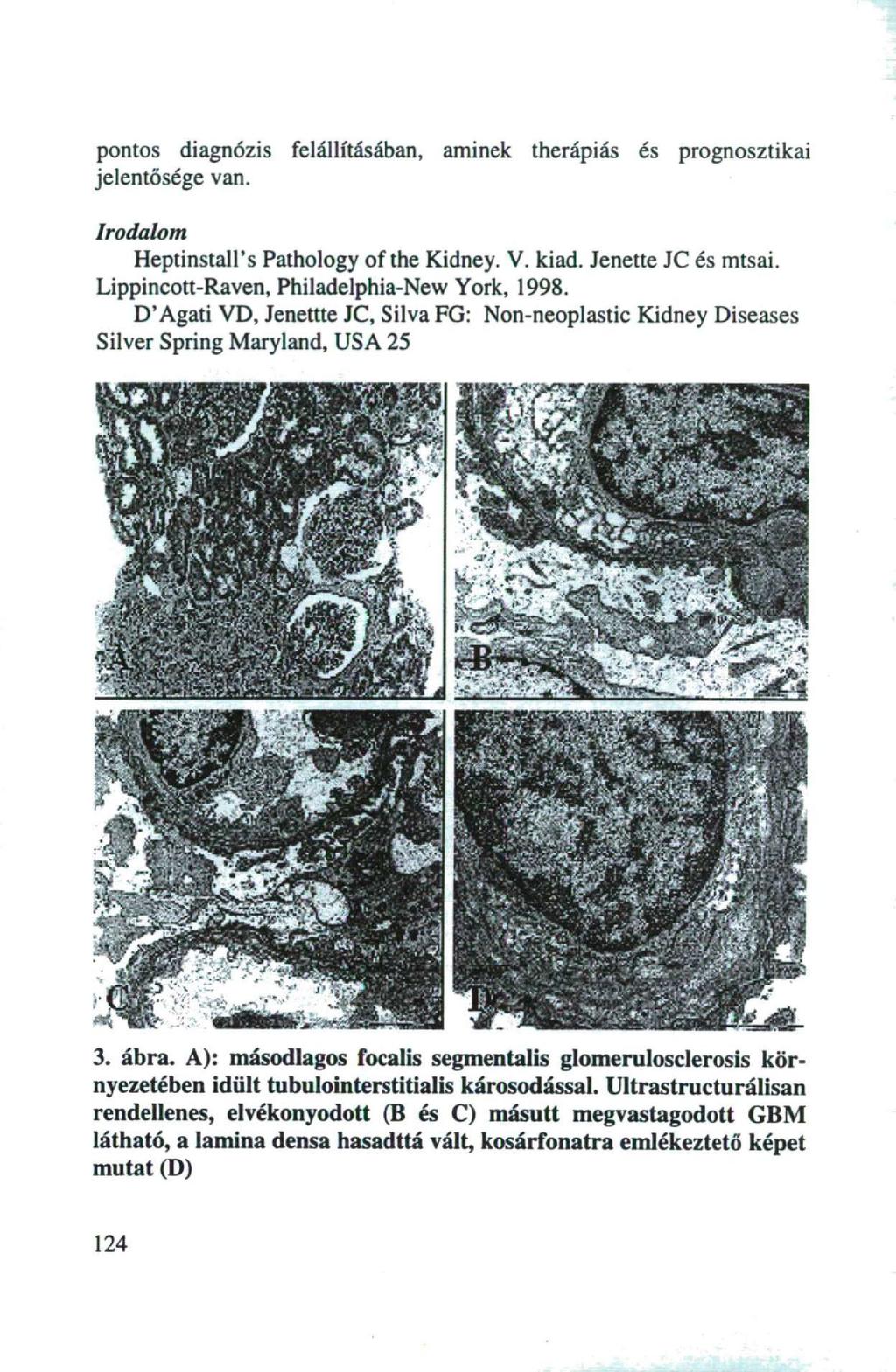 pontos diagnózis felállításában, aminek therápiás és prognosztikai jelentősége van. Irodalom Heptinstall's Pathology of the Kidney. V. kiad.
