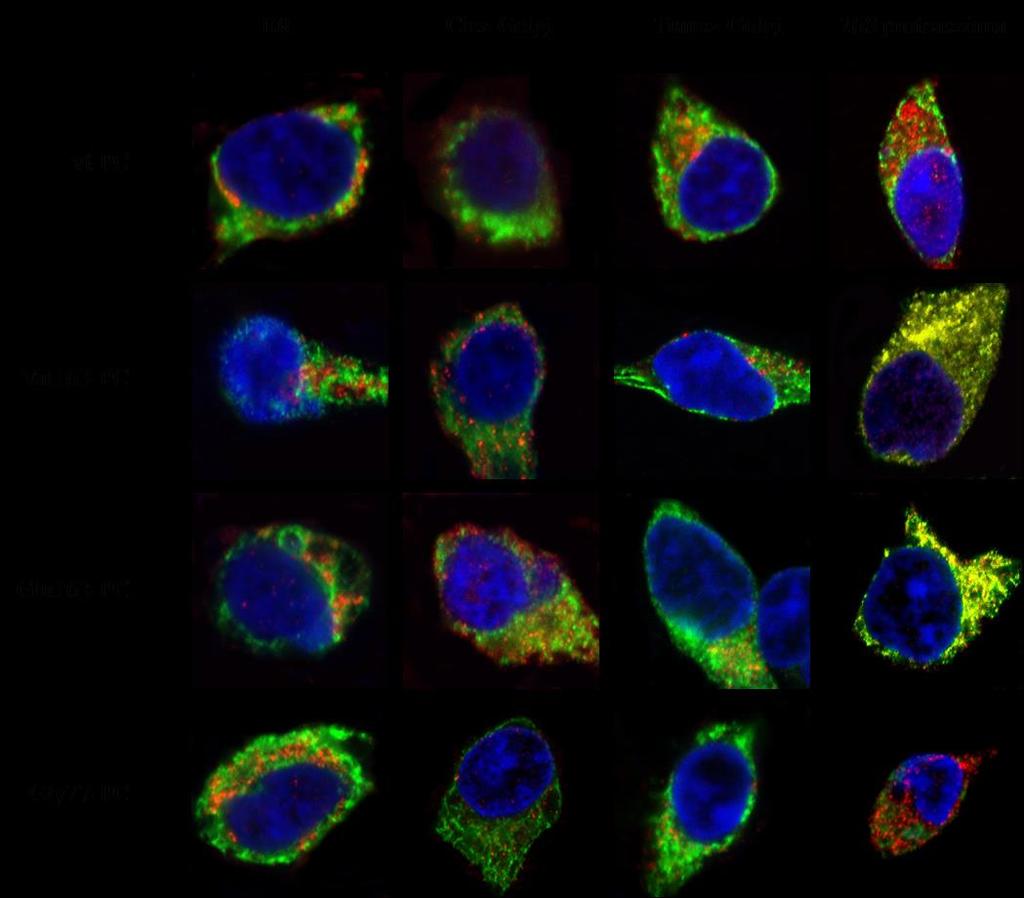 11. ábra. A vad típusú, a 163Val és 163Glu PC mutánsok kettős immunfluoreszcens festése.