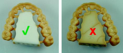 ELÕSZÁRÍTÁS ÉS SZINTEREZÉS Elõszárítás és szinterezés Előszárítás A Ceramill Liquiddel történő színezés után a Ceramill Zolid termékeket előszárításnak kell alávetni.