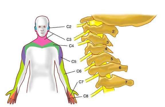 Cervicocranialis, cervicobrachialis sy.