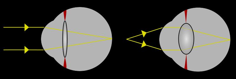 000 Cornea, n = 1.376 csarnokvíz, n = 1.