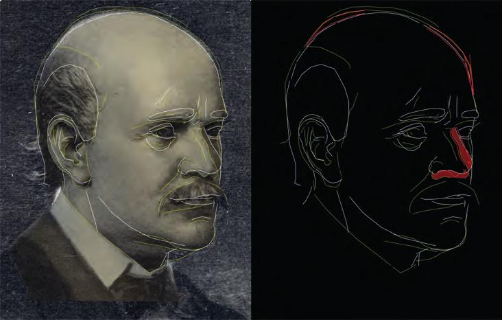 Semmelweis Ignác arcrekonstrukciója 257 13. ábra. bal: Az arckép és az arcrekonstrukció illesztése a II.