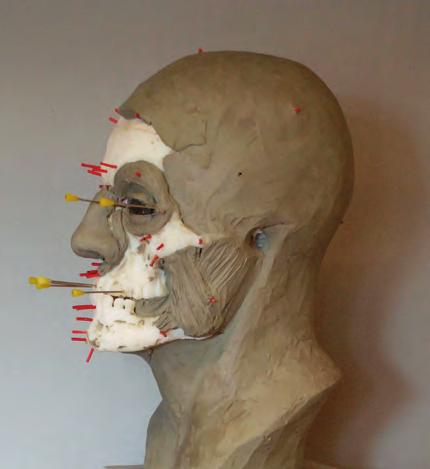 Phase I of the sculpting craniofacial reconstruction: Pins marking the thickness of soft tissues are fixed onto the plastic skull.