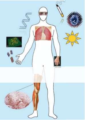 Myositisek/Idiopathiás Inflammatorikus myopathiák Szisztémás autoimmun kórképek jellegzetes