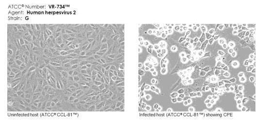 5. Vírusok citopátiás hatásának vizsgálata 4 A sejtekben a vírusra jellemző citopátiás (sejtkárosító) hatás alakul ki: - A vírus hatására a sejtek zsugorodhatnak, lekerekedhetnek, többmagvú