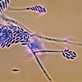 A kórokozó fonalas gombák, mint például a fuzárium, zavartalan szaporodásához és növekedéséhez nélkülözhetetlen a vasionok (Fe +++ ) jelenléte.