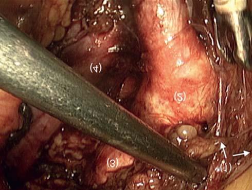 A kismedencei vegetatív beidegzés neuroanatómiája plexus hypogastricus inferiorba csatlakozásuk révén (4, 9).