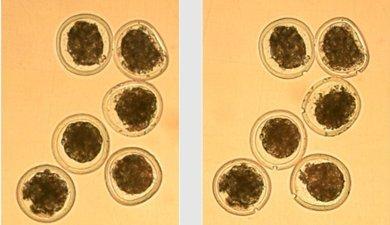 Biotechnika (ET) és biotechnológia (OPU, IVF)