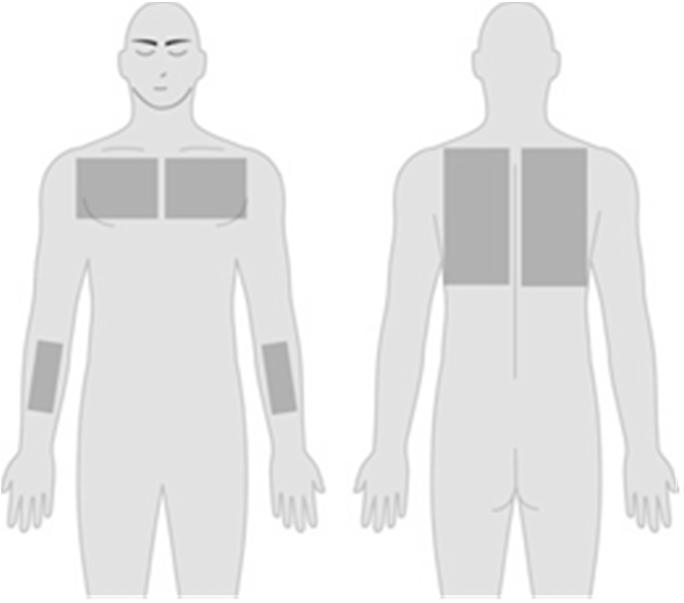 Intracutan/intradermalis(ID) injekció bőr rétegei közé lassú felszívódás általában