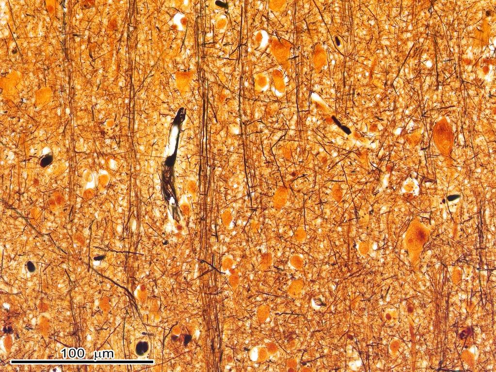 Neuronok: speciális funkciójú postmitoticus sejtek a kéregben (szürkeállomány), az