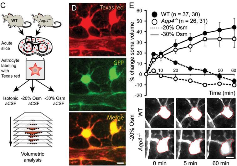 AQP4 deletion in mice has little or no effect on development, survival, growth, and neuromuscular function, but produces a small defect in urinary concentrating ability consistent with its expression