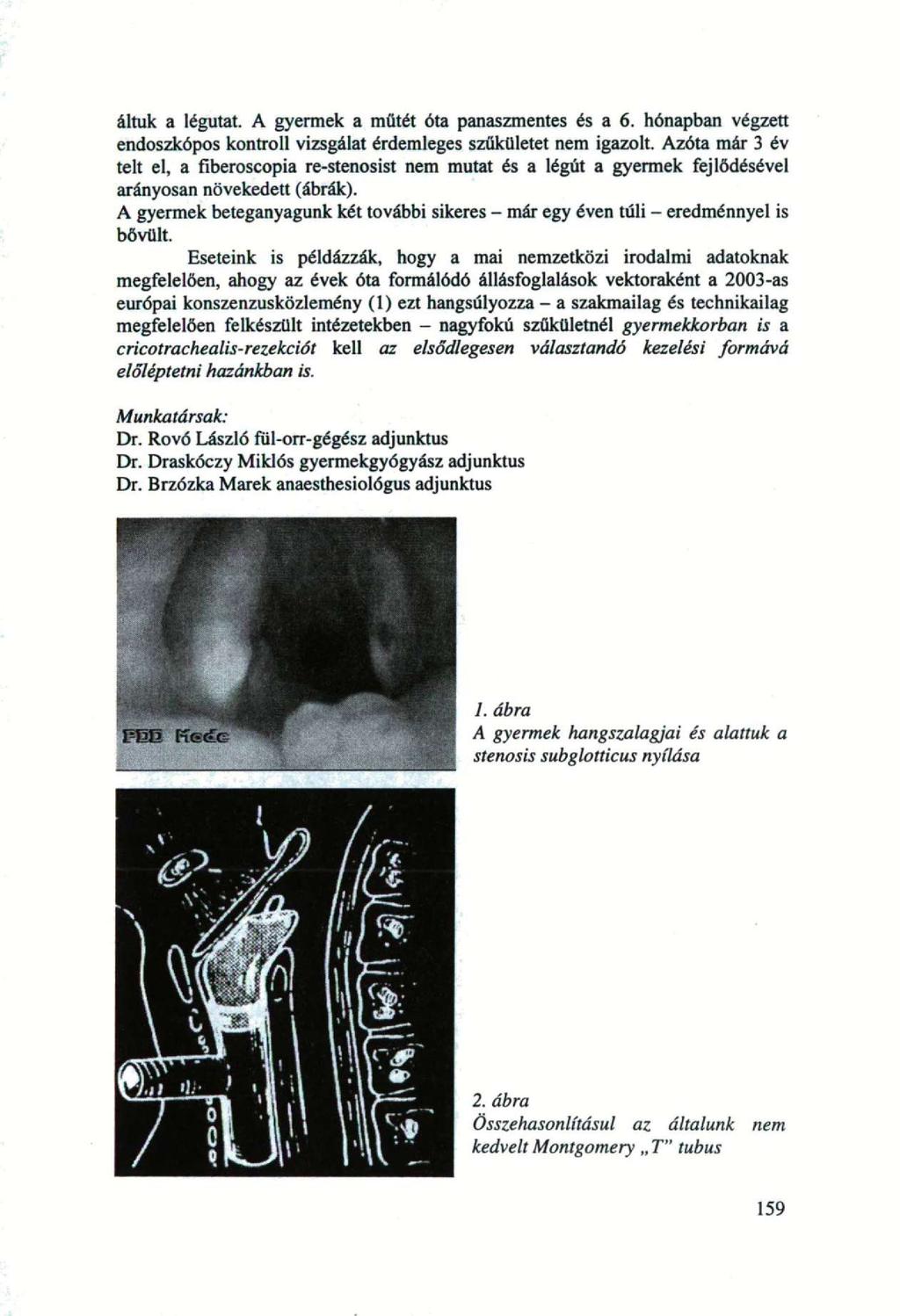 áltuk a légutat. A gyermek a műtét óta panaszmentes és a 6. hónapban végzett endoszkópos kontroll vizsgálat érdemleges szűkületet nem igazolt.