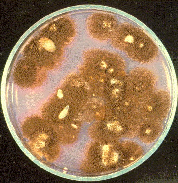 Aspergillus ochraceus toxinjai: ochratoxin A, B, C és ciklopiazonsav Ocharatoxin A