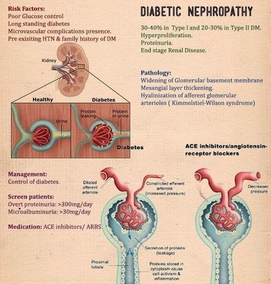 A diabeteszes