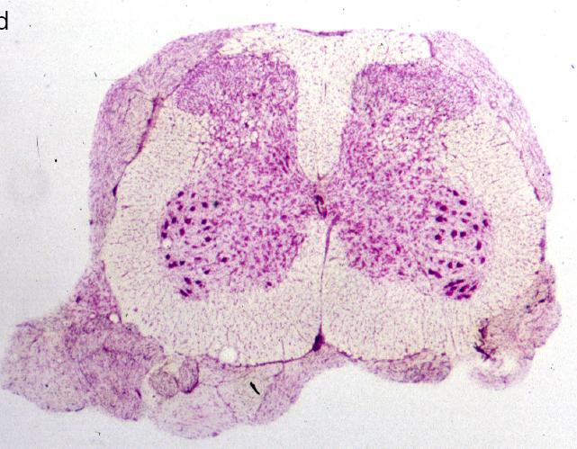 gerincvelő keresztmetszeti