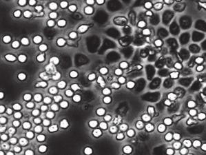 A B Szuperoxid-termelés (nmol/10 6 sejt) 3 2 1 0 Fbg + TNF 0 20 40 60 Id (perc) 3 2 Vad típus 1 CD18 / p190rhogap / 0 30. perc 60.