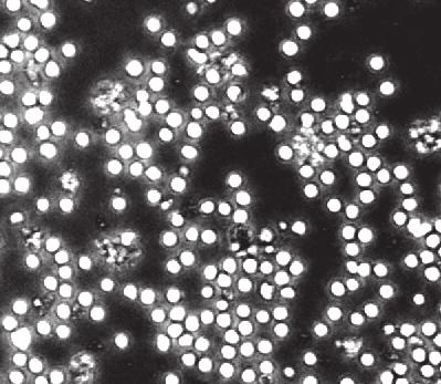 percnél klasszikus és szuboptimális TNF koncentrációk esetében (kontrollok levonva, átlag + SEM, *p<0,05) (Publikálva: [II]) TNF jelenlétében, integrin-ligand felszínen a neutrofilek szétterültek: