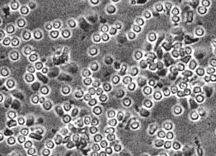 a zselatináz zimogramon, mely folyamat egyértelmħen Fc-receptor Ȗ-lánc függęnek bizonyult.