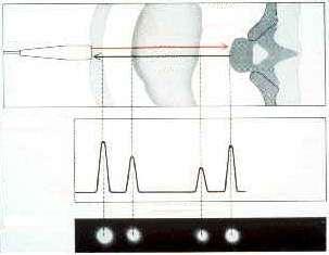transzducer pulzus d ekhó A-kép (Amplitúdó) csak egydimenziós lehet egydimenziós B-kép