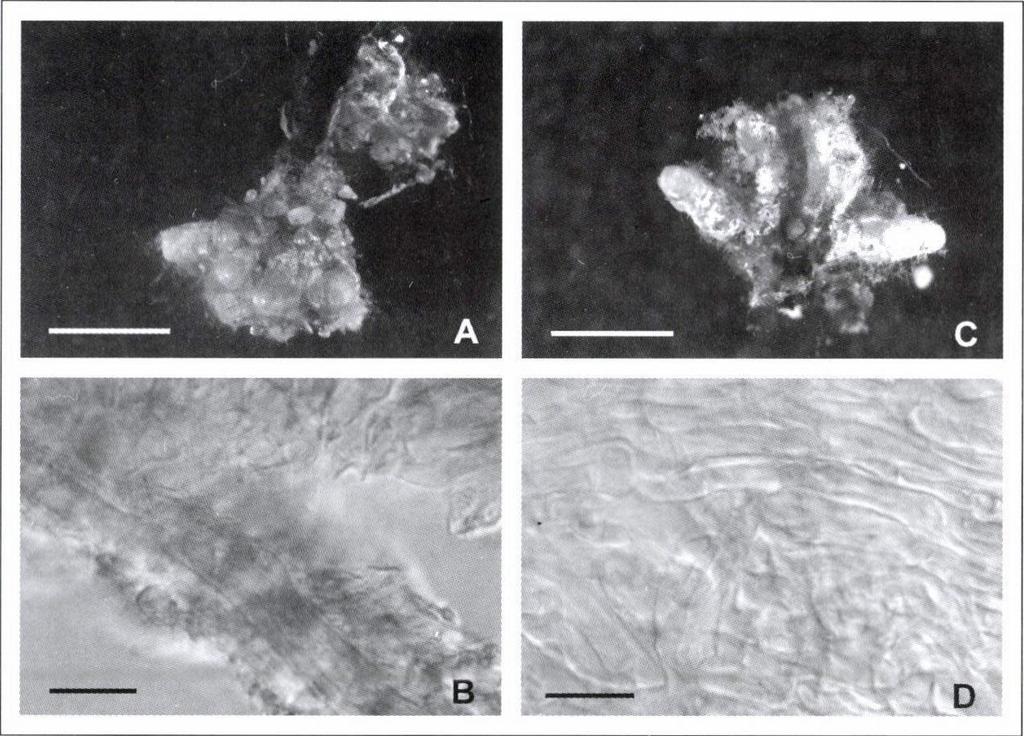A Rhizopogon roseolus és a Suillus collinitus ektomikorrhizái és gombaköpenye. A = R. roseolus ektomikorrhiza (mérce = 1 mm); B = R.