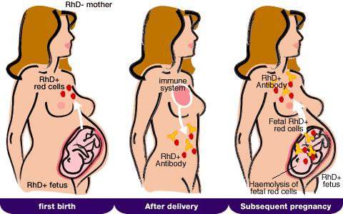 Immunglobulin készítmények Monovalens Ig-ok (passzív immunizáció) Anti-D IgG szülészet: Rh /D/ izoimm. megelőzése (az Rh/D/ izoimm-ra veszélyeztett egyén: az Rh /D/ neg.