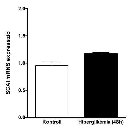 28. ábra: Podocita SCAI mrns expresszió qpcr vizsgálattal.