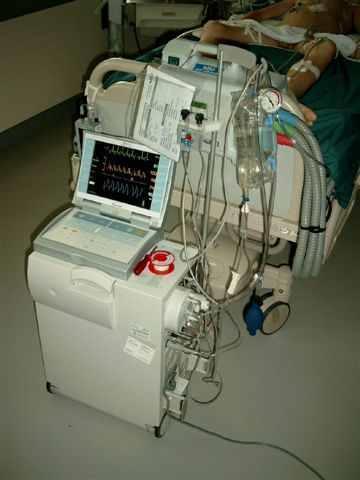 Indikációk: Terápiarefrakter kardiogén shock Terápiarefrakter angina vagy ritmuszavar Akut mitrális regurgitatio és VSD Bridge-to-transplant terápia végstádiumú krónikus szívelégtelenségben