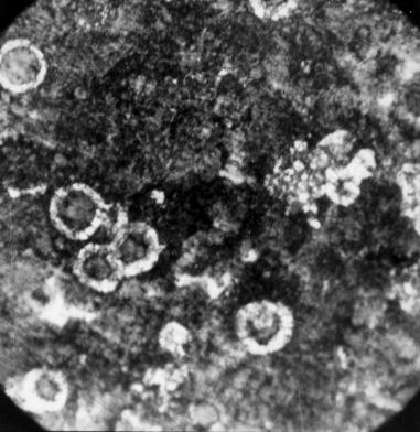 Microstructure of bearing casted from nodular graphite iron 400, with 12 minutes casting time, magnification x100: