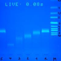 Elektroforézis A DNS protein kölcsönhatás bizonyítása EMSA (electrophoretic mobility shift assay).