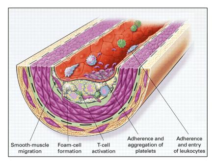 - pathological conditions - altered anticoagulant & anti-inflammatory properties - impaired modulation of vascular growth &