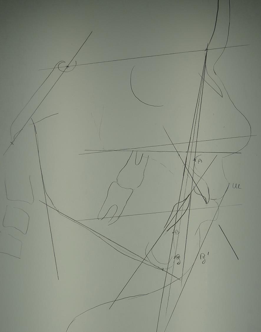 Tele