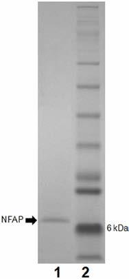 9. Ábra. A fehérjetisztítás után antifungálisan aktívnak mutatkozó frakciók fehérjetartalma 4-12% Bis-Tris SDS PAGE-en, Coomassie-kék festés után 1.