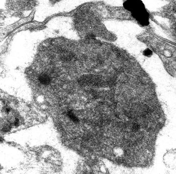 ábra). a a d d 2. ábra. Azonosított szinapszisok a propriospinalis axon terminálisok (a) és a motoneuron dendritek (d) között.