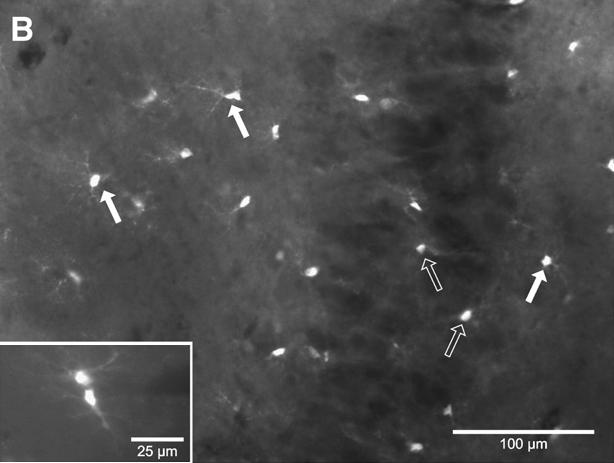 A szeleteket sejtpenetráló szubsztráttal (50 µm) 5 percig kezelve, majd A