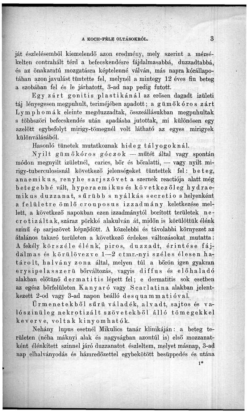 A K0CH-FKLE OLTÁSOKRÓL.