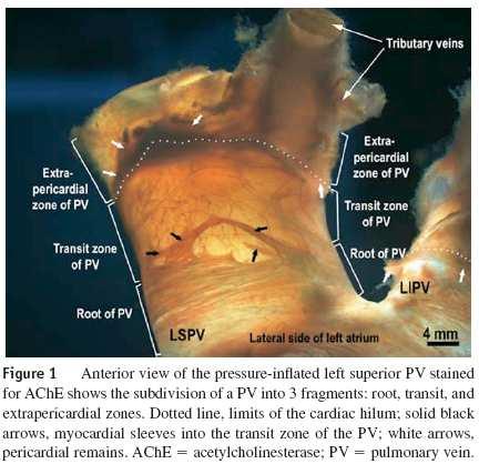 PV anatomy I Antral ganglion