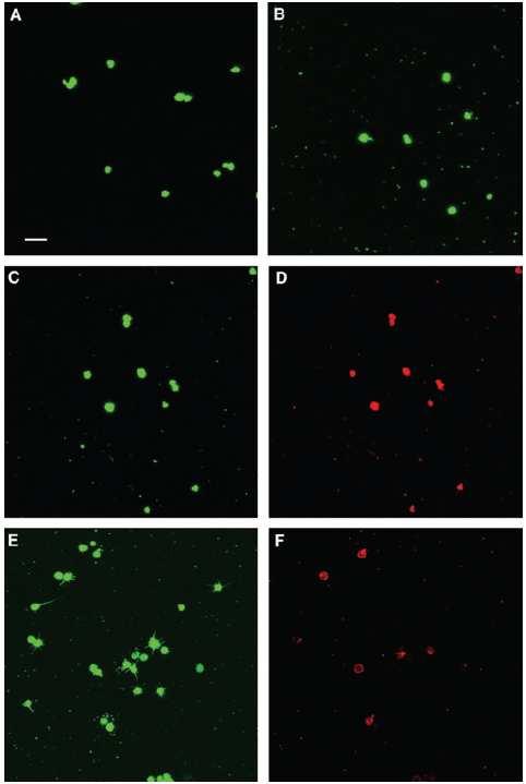 5 µm 14. ábra [42] A vérlemezke mikropartikulák konfokális mikroszkópos vizsgálata. A. A bodipy-maleimiddel jelölt vérlemezkék intenzíven világítanak. B.