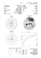 - shunt implantáció SSS stenosis - endovascularis stent implantació 4.